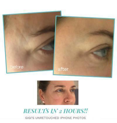 SIO Beauty- Eye + Smile LIft 2pk Skincare - Special SIO Beauty 