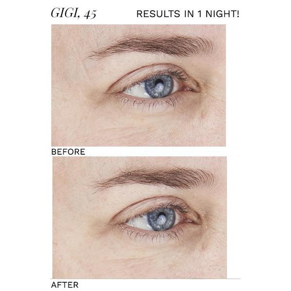 SIO Beauty- Eye + Smile Lift 4pk Skincare - Special SIO Beauty 