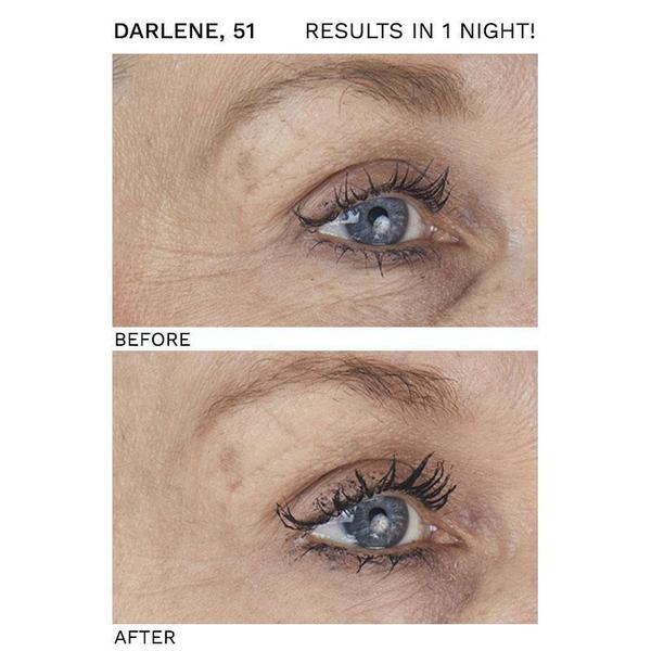 SIO Beauty- FaceLift Skincare - Special SIO Beauty 